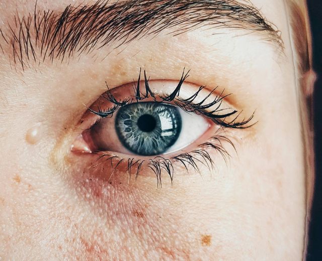 Focusing oog